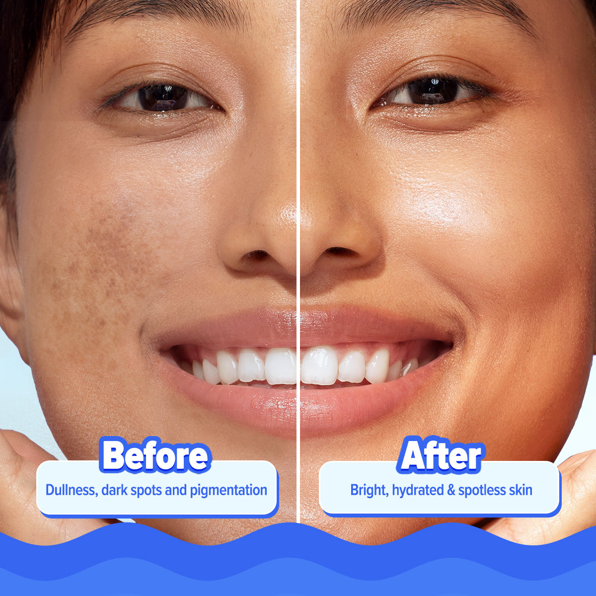 Bright+ Hydra Gel Moisturizer with Blueberry & Kojic Acid - 200 g