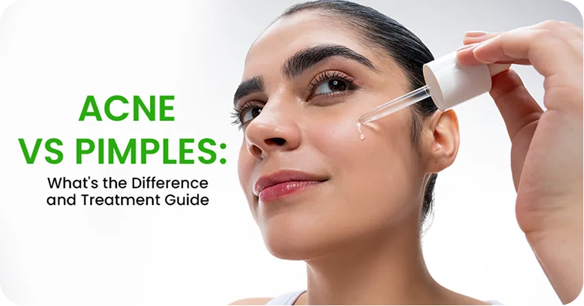 Acne vs Pimples: What's the Difference, and What Changes in Your Routine