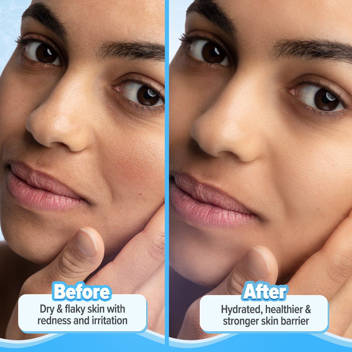 5 Barrier+ Repair Moisturizer with Avocado & 5 Essential Ceramides - 100g