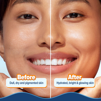 Glow+ Hydra Gel Moisturizer with Vitamin C & Papaya - 20 g