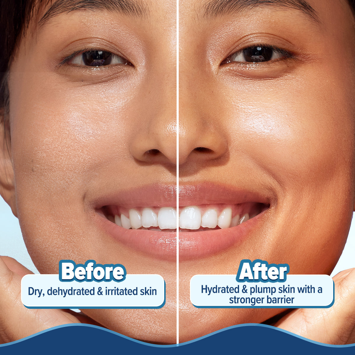 5 Barrier+ Hydra Gel Moisturizer with Avocado & 5 Essential Ceramides - 100 g